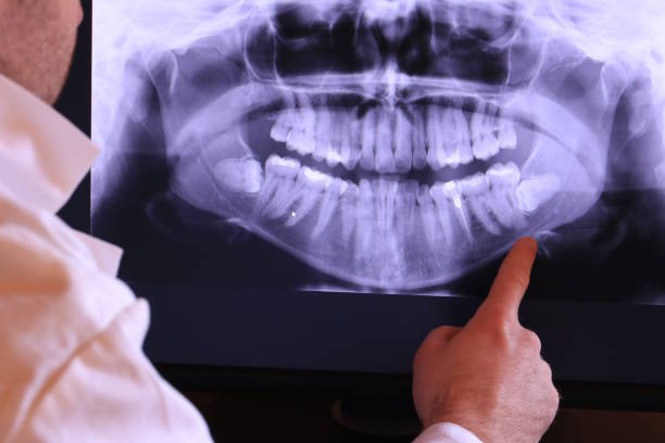 Best Emergency Treatment for Dental Infections or Abscesses in Anna, OH