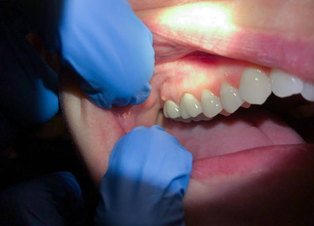 Best Urgent Care for Lost Fillings or Crowns in Anna, OH