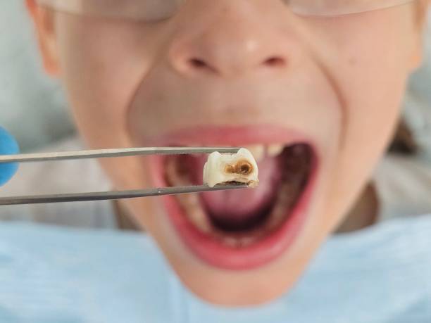 Best Pediatric Emergency Dentist in Anna, OH